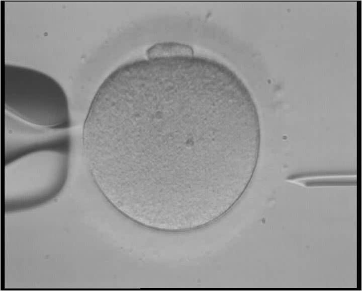 an egg held by a pipette and injected during an in vitro fertilization procedure under a microscope