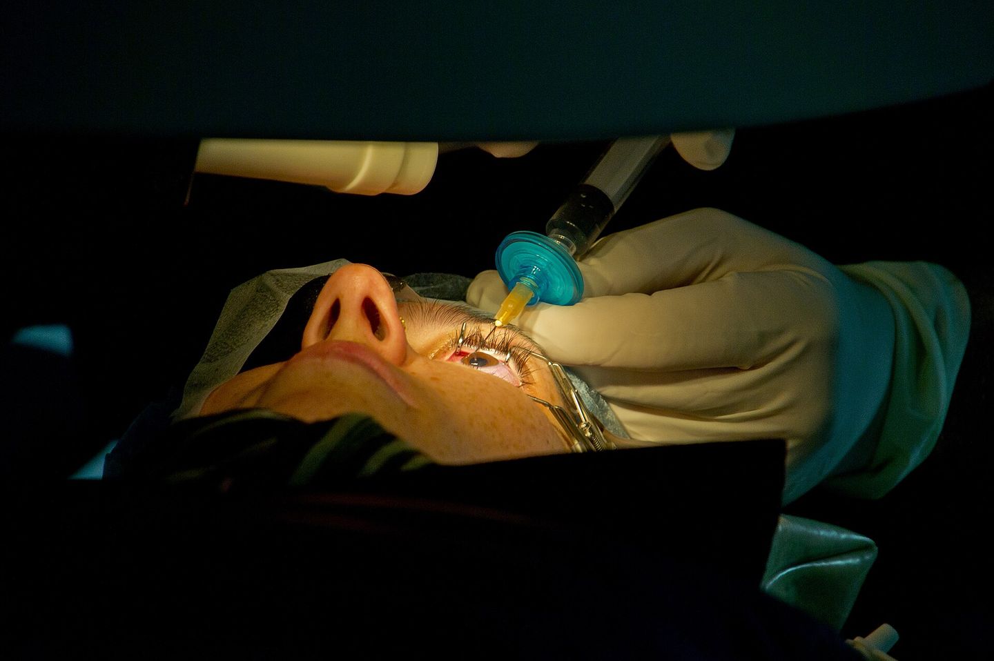 a surgeon performing laser eye surgery on a patient